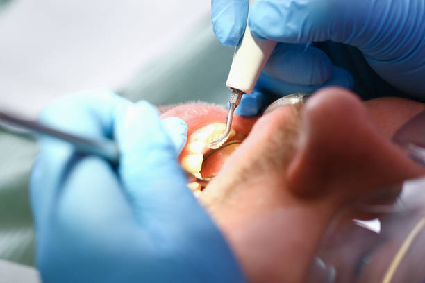 Best Emergency Treatment for Toothache in Ash Flat, AR